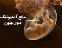 مایع آمنیوتیک دور جنین